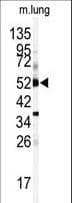 Polyclonal Rabbit anti-Human CYP1A1 Antibody (aa252-280, IHC, IF, WB)