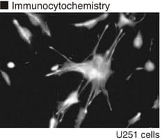 Vimentin Antibody (phospho-Ser82, clone MO82)