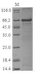 Nostoc alr2278 Protein (Recombinant MBP, N-terminus + 6His, C-terminus)