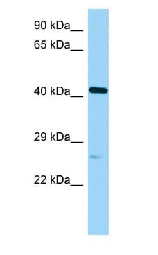 POC1A / SOFT Antibody (aa242-291)