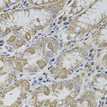 Polyclonal Rabbit anti-Human VIP Antibody (IHC, WB)