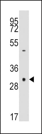 Polyclonal Rabbit anti-Human CASP3 / Caspase 3 Antibody (aa60-90, IHC, WB)