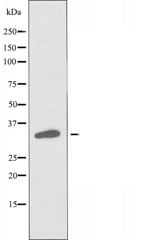 JCG1 / OR5P3 Antibody