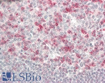 IHC-plus™ Monoclonal Mouse anti-Human PDCD1 / CD279 / PD-1 Antibody (clone 2F6, IHC, IF, WB)