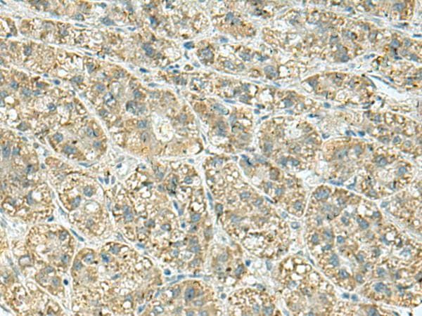JPH1 Antibody