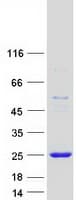 Human CTAG1A Protein (Recombinant Myc-DDK (Flag))