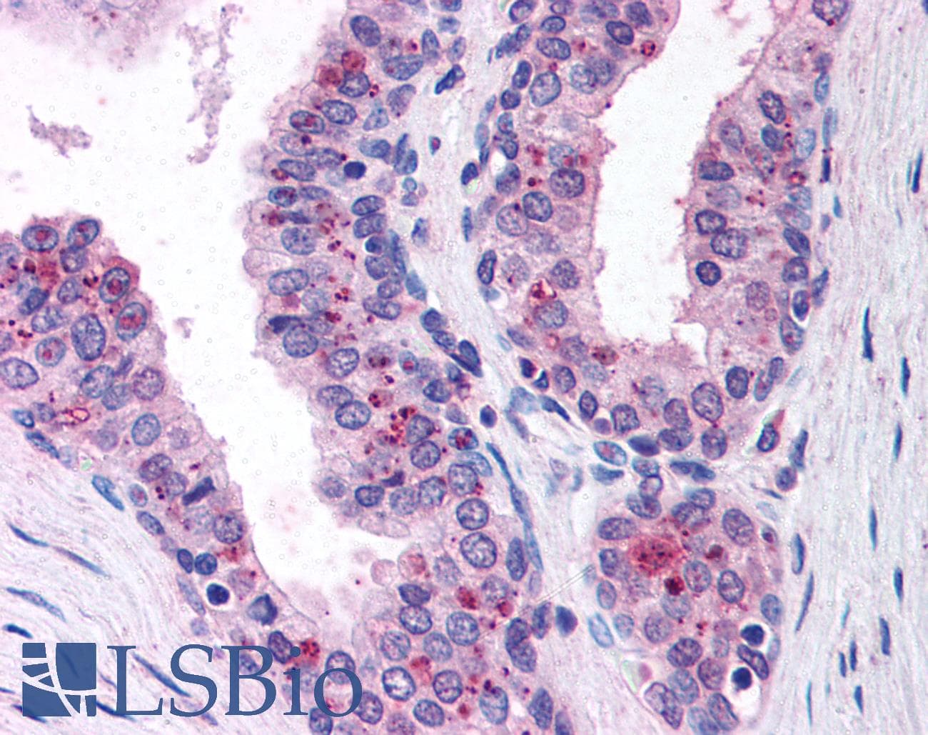 IHC-plus™ Monoclonal Mouse anti-Human CASP9 / Caspase 9 Antibody (clone LAP6 96-2-22, IHC, WB)