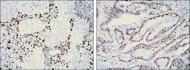 MKI67 / Ki67 Antibody (CEDLAGFKELFQTPG, clone 8D5)