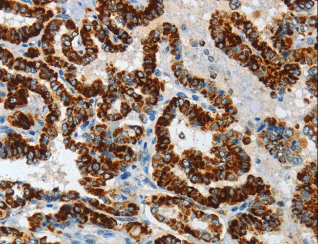 ASB4 Antibody