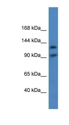 LONP2 / LONP Antibody (aa570-619)