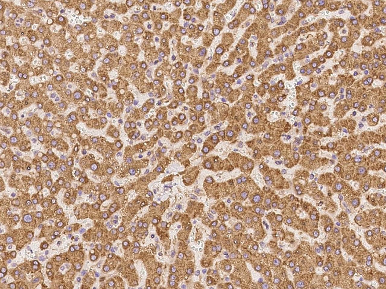 Polyclonal Rabbit anti-Human MGST2 Antibody (IHC)