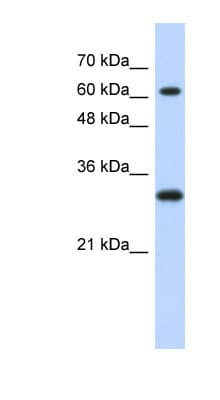 Polyclonal Rabbit anti-Human ERF / PE2 Antibody (aa371-420, WB)