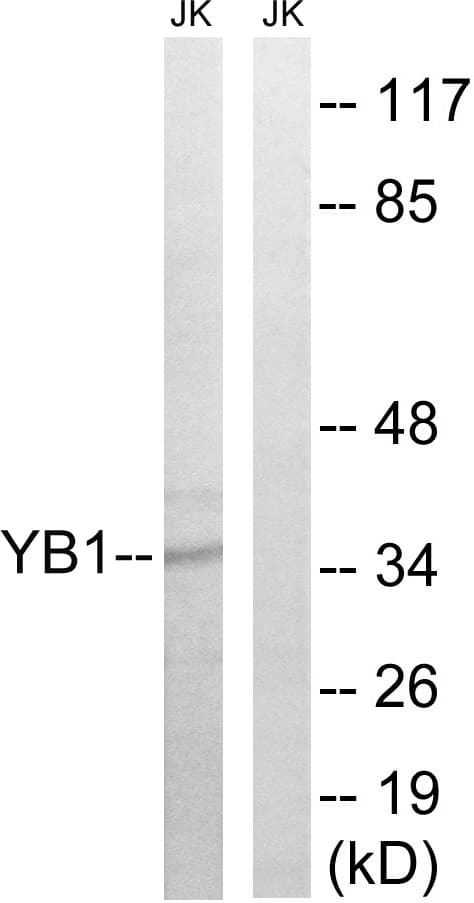 Polyclonal Rabbit anti-Human YBX1 / YB1 Antibody (aa68-117, WB)