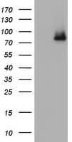 NBN / Nibrin Antibody (clone OTI6D10)