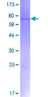 Human FOXP3 Protein (Recombinant GST)