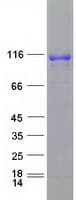 Human DPP6 / Dipeptidylpeptidase 6 Protein (Recombinant Myc-DDK (Flag))