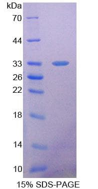 Mouse SDHA Protein (Recombinant His-T7)