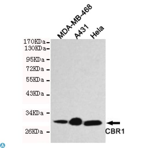 Monoclonal Mouse anti-Human CBR / CBR1 Antibody (WB)