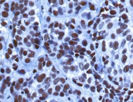 KDM5B / JARID1B Antibody (aa800-850)