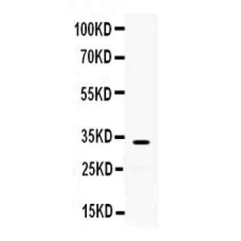 Polyclonal Rabbit anti-Human TREX1 Antibody (aa156-185, WB)