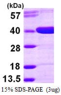 Human AKR1D1 Protein (Recombinant His)