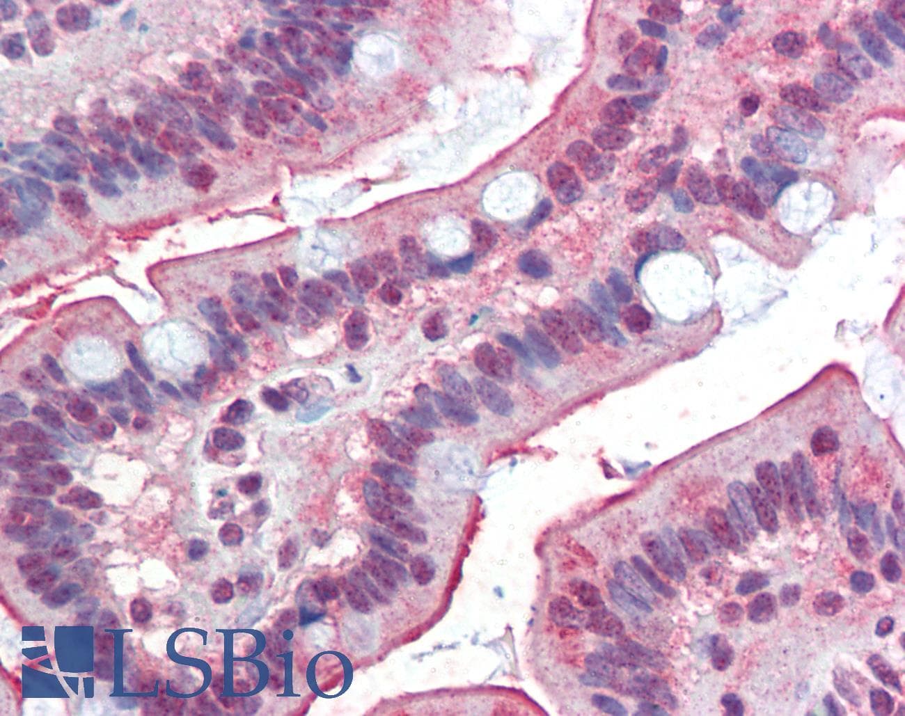 IHC-plus™ Polyclonal Goat anti-Human DGAT1 Antibody (aa67-79, IHC, WB)