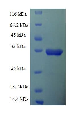 Human IGF1R / IGF1 Receptor Protein (Recombinant GST)
