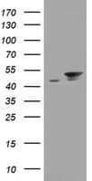EPHX1 / Epoxide Hydrolase 1 Antibody (aa21-230, clone OTI3F11, Carrier-free)