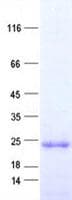 Human IFNL2 / IL28A Protein (Recombinant His, N-Terminal)