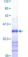 Human SERPINE1 / PAI-1 Protein (Recombinant GST, N-terminus)
