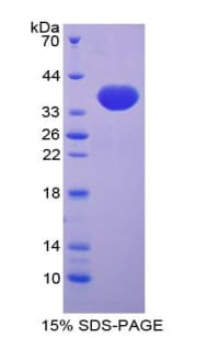 Mouse TFF3 / Trefoil Factor 3 Protein (Recombinant His-GST)