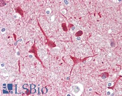 PathPlus™ Polyclonal Rabbit anti-Human FGF19 Antibody (IHC, WB)