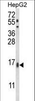 MGST2 Antibody (aa117-147)