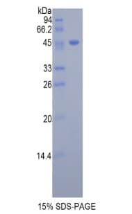 Mouse Dermatopontin / DPT Protein (Recombinant His-GST)