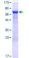 Human AHDC1 Protein (Recombinant GST)