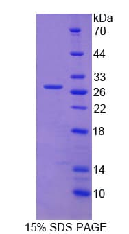 Human SRY Protein (Recombinant His, N-Terminal)