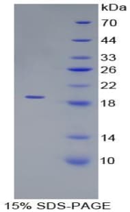 Mouse PRDX5 / Peroxiredoxin 5 Protein (Recombinant His)