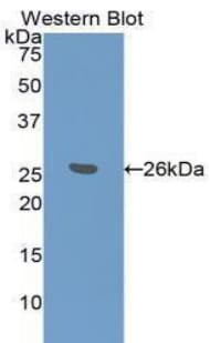 BID Antibody (aa1-195, APC)