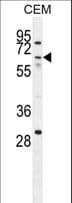 ZNF674 Antibody (aa74-102)