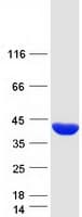 Human FBP1 Protein (Recombinant Myc-DDK (Flag))