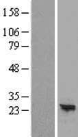 ARL16 Protein (Over-Expression Lysate Myc-DDK (Flag))