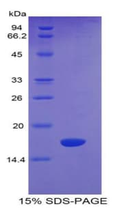 Mouse SEMA4D / Semaphorin 4D / CD100 Protein (Recombinant His)