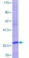 Human BCL2 / Bcl-2 Protein (Recombinant GST, N-terminus)