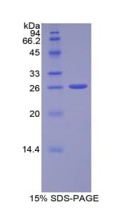 Human ADAM10 Protein (Recombinant His)