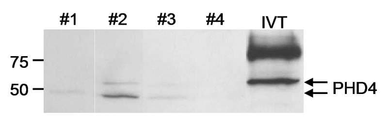 Polyclonal Rabbit anti-Human PH4 / P4HTM Antibody (aa450-C-term, WB)