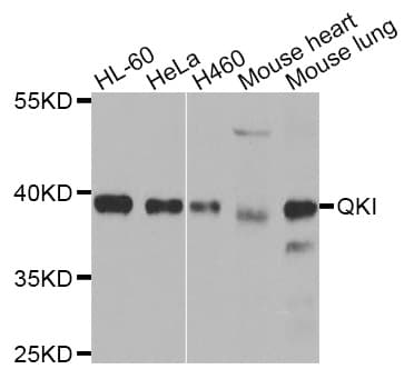 Polyclonal Rabbit anti-Human QKI Antibody (IHC, IF, WB)