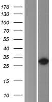 HOXC9 Protein (Over-Expression Lysate Myc-DDK (Flag))