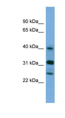 PPHLN1 Antibody (N-Terminus)