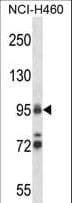 Polyclonal Rabbit anti-Human TOP1 / Topoisomerase I Antibody (aa2-31, IF, WB)