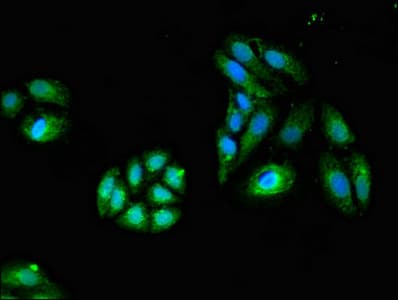 Polyclonal Rabbit anti-Human GZMK / Granzyme K Antibody (IHC, IF)
